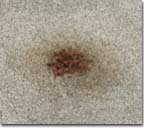 stain on carpet